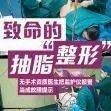 315调查｜把监护仪报警当故障提示，当地通报“女子抽脂死亡”