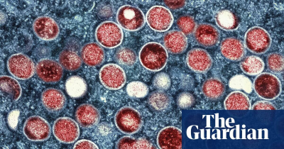 The Guardian - China-China fuels global surge in mpox cases as LGBTQ stigma hampers response