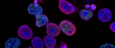 科学家发现一种全新的类病毒样实体，可能存在于超半数人的口腔微生物中 | 环球科学要闻